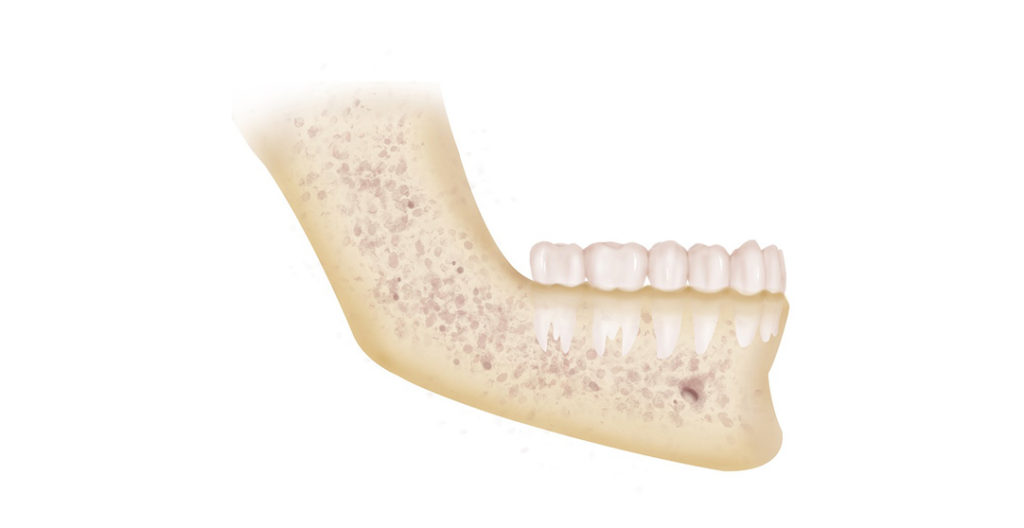 Lower jaw with all of the teeth in place